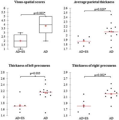 Precuneus-Dominant Degeneration of Parietal Lobe Is at Risk of Epilepsy in Mild Alzheimer's Disease